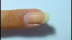 How to series - Get rid of a hangnail