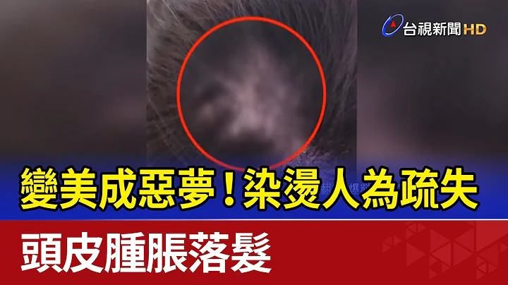 變美成惡夢！染燙人為疏失 頭皮腫脹落髮 - 天天要聞
