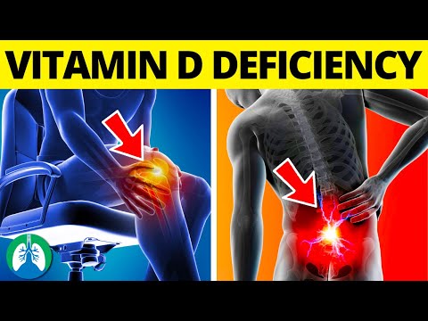 ☀️Top 10 Signs of Vitamin D Deficiency That You MUST Know