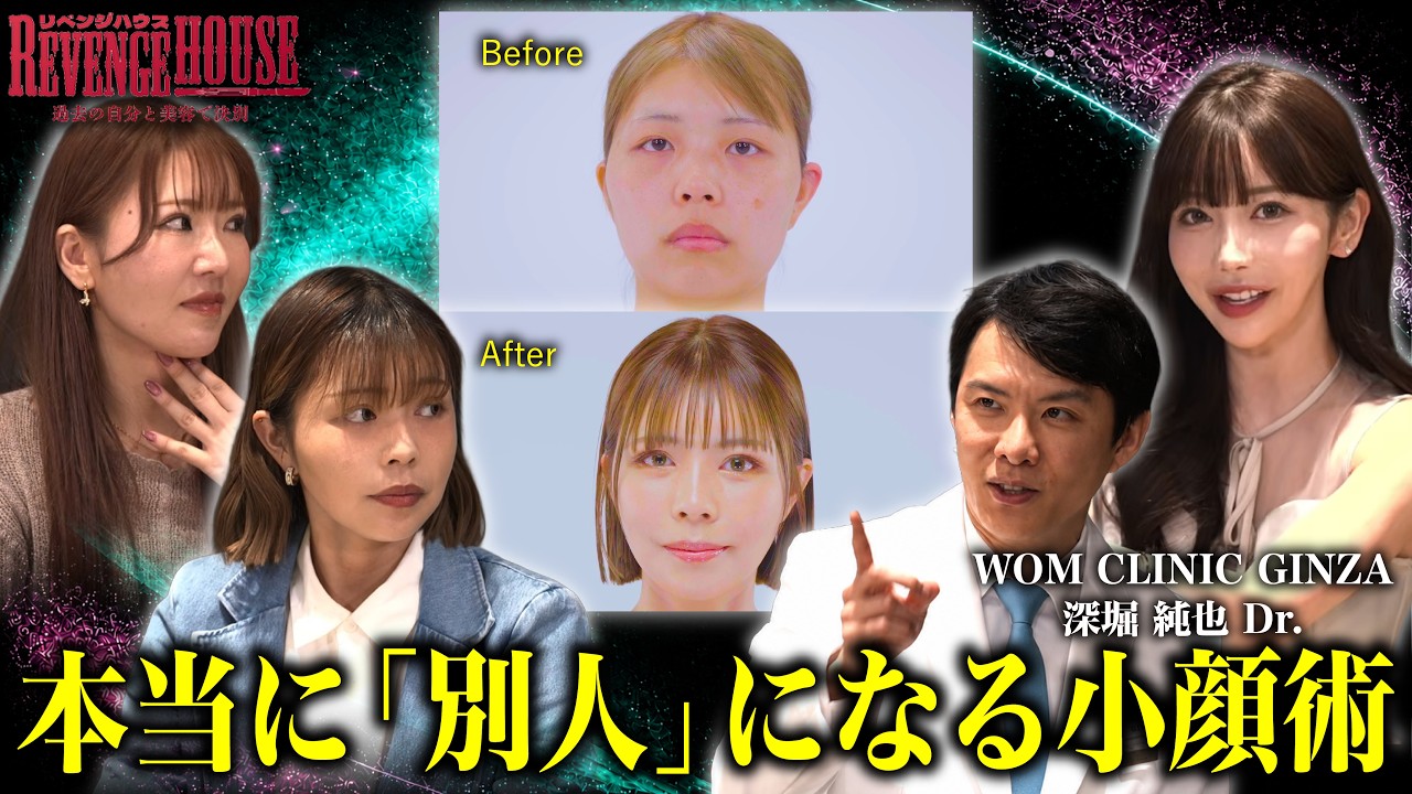 Rちゃんも絶賛!ワムクリニック深堀先生が教える「失敗しない輪郭整形・骨切り」のリアル