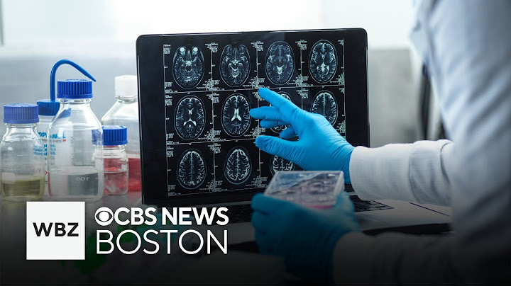 People with dementia living longer in five regions of the world