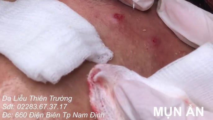 4. Những Sai Lầm Thường Gặp Khi Chăm Sóc Da