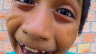 Peru Orphanage Update - Smarter Every Day 163