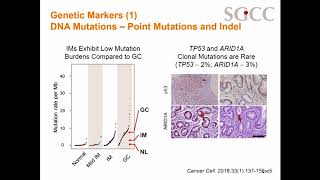 Novel Molecular Risk Stratification Tools in Intestinal Metaplasia: The Singaporean Experience