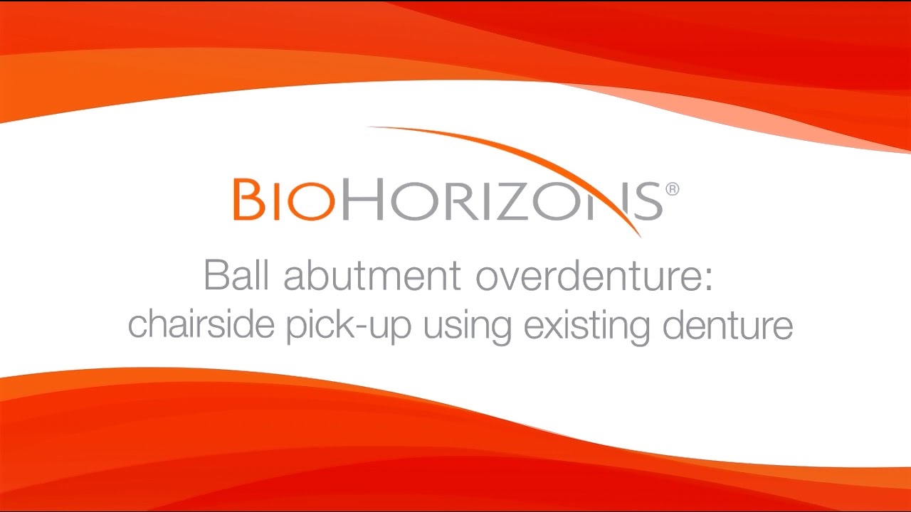 ball abutment overdenture: chairside pick-up using existing denture