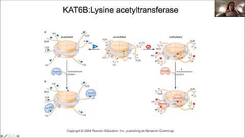 A Review on KAT6B Disorders by Gabrielle Lemire, M...
