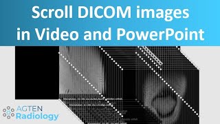 How To Scroll Dicom Images In Video Presentations And Powerpoint