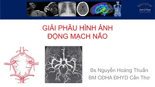 Giải phẫu hình ảnh động mạch não