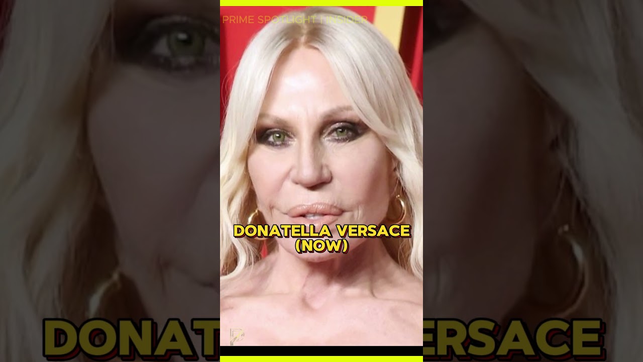 TOP 5 Celebrity Ruined by Plastic Surgery 💉