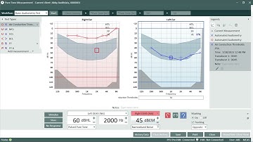 Audiometric Masking In Auditdata Measure