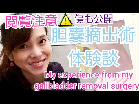 My experience from my gallbladder removal surgery.  胆嚢摘出術の体験談