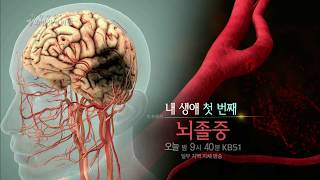 170906 생로병사의비밀 예고 ㅣ KBS방송