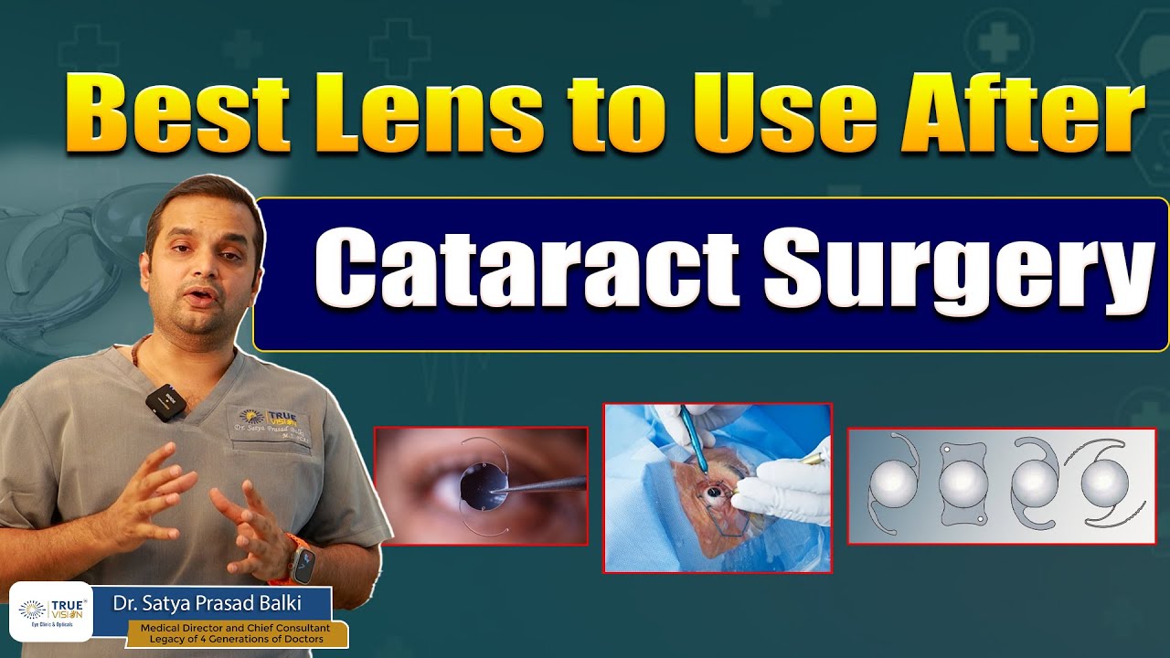 best-lens-to-use-after-cataract-surgery-best-eye-lenses-2024-true