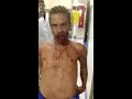 Hombre poseido en un hospital de Brasil
