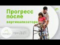 Аппараты на нижние конечности при ДЦП.