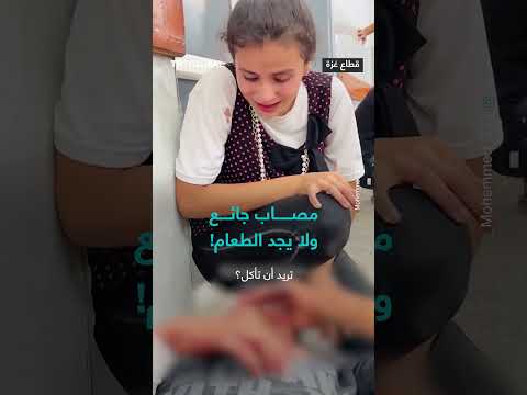 مصاب جائع يبحث عن طعام