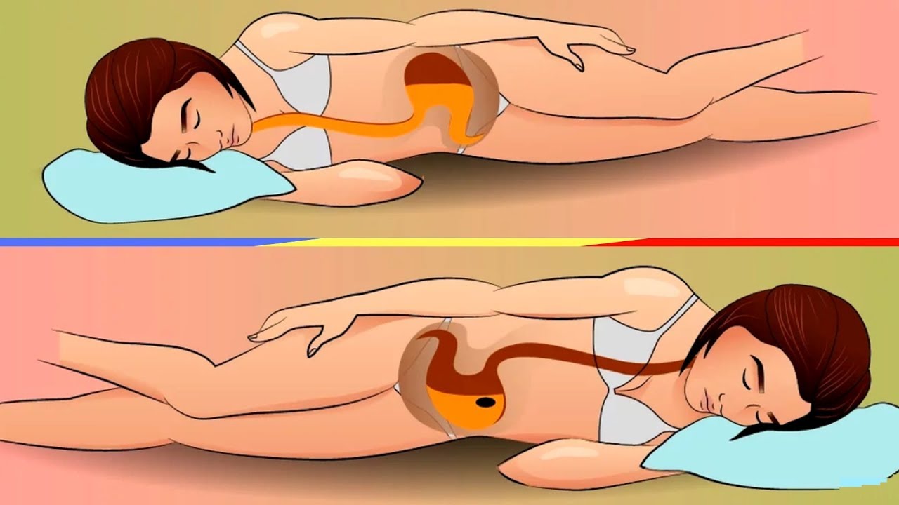 Сколько можно лежать на животе. При ГЭРБ спать на левом боку. На каком боку спать. Поза на левом боку. Правильная поза для сна.