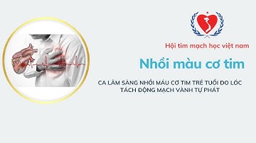 CA LÂM SÀNG NHỒI MÁU CƠ TIM TRẺ TUỔI DO LÓC TÁCH ĐỘNG MẠCH VÀNH TỰ PHÁT - MIA HỌC Y