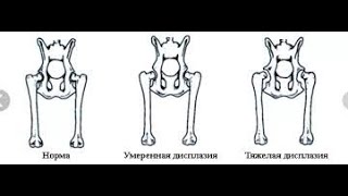 дисплазия тазобедренного сустава/ локтя что делать? Реабилитация и упражнения