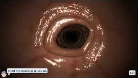 EndoSim Fundamental Endoscopy Skills 2: Mucosal Examination