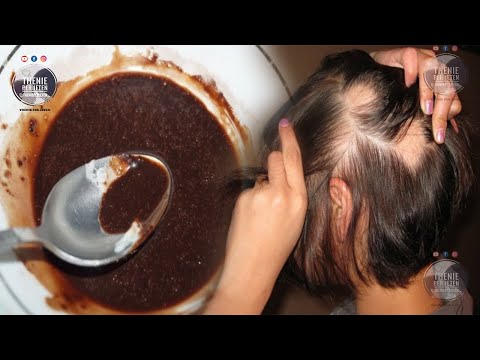 Video: A shkaktojnë rënie të flokëve shiritat?