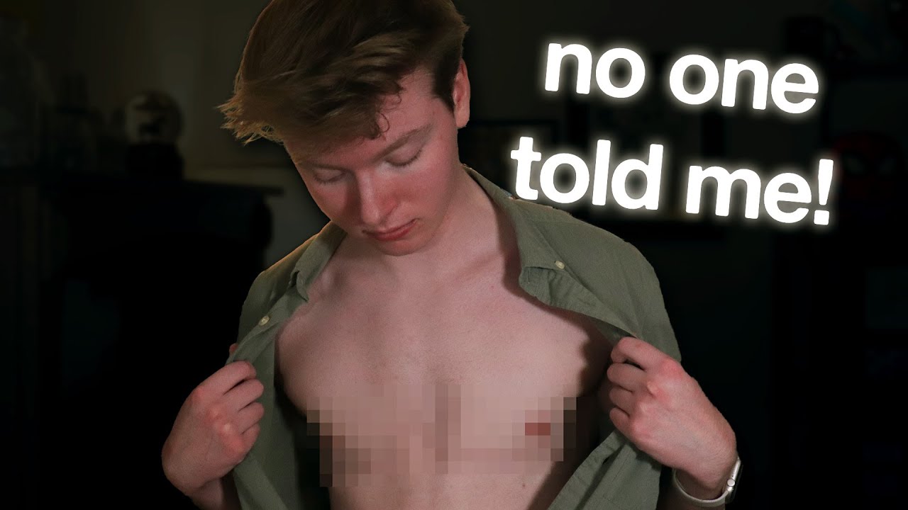 Top Surgery: What No One Tells You (I Wish I Knew This!)