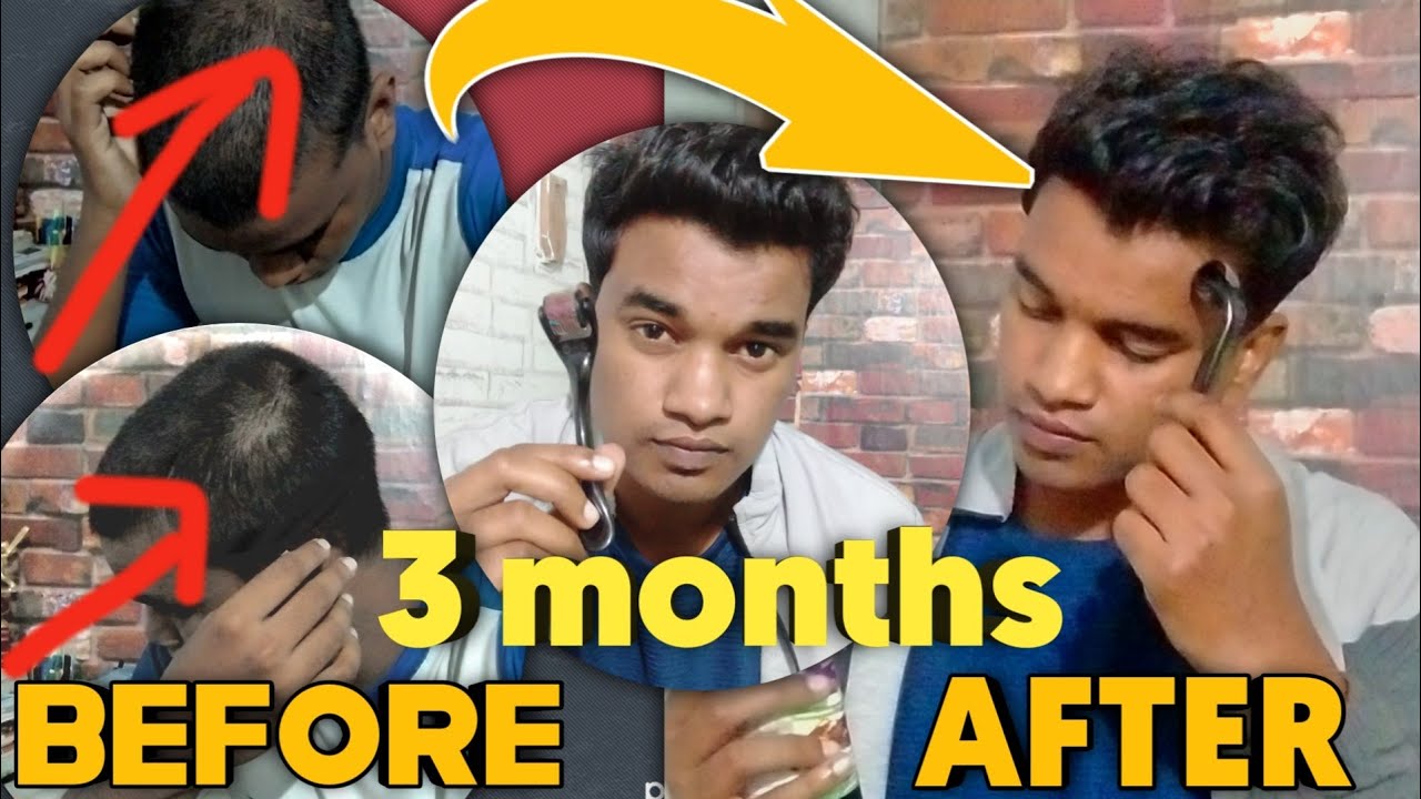 sambalpur stophairfall How to stop hair fall sambalpuri real