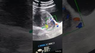 tonight case #ultrasound