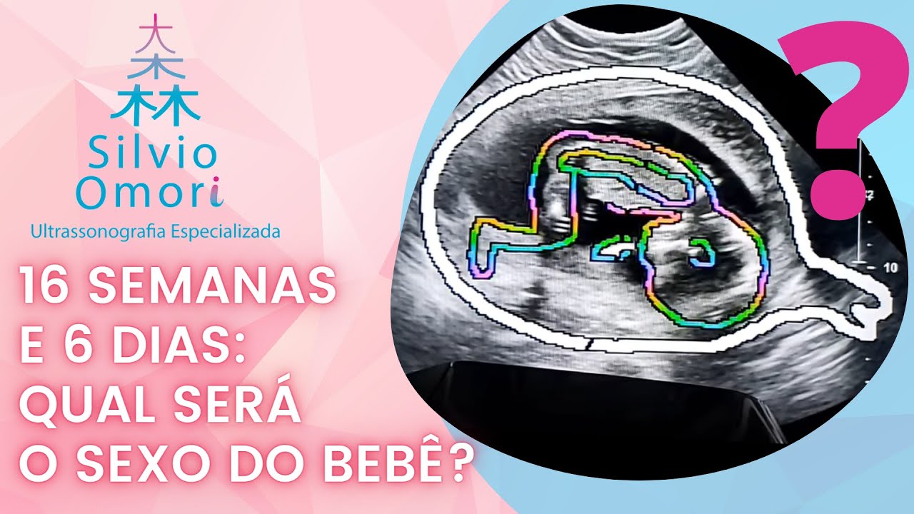 Gravidez 16 semanas Ultrassom: descobrindo o sexo do bebê? Dr.Silvio ...
