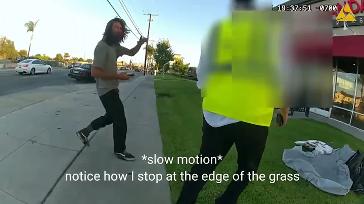 Santa Ana Police Breaking My Arm