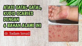 Overcome Itching Scabies or Ringworm With 6 Natural Ingredients