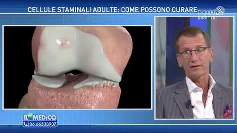 Quali sono le cellule staminali mesenchimali?