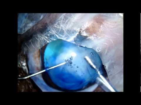 Cataract Surgery in a Dog (VETWEB)
