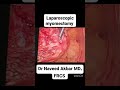 laparoscopic myomectomy in Jhang for the first time to treat the secondary infertility .