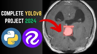 Brain Tumor Detection Using YOLOv8 Project 2024 || #Freetech #machinelearningproject