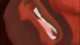 Plotagon poop