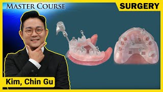 健康・医学 216 IMPLANTS Ultimate guide The Ultimate Guide To Dental Implants | Published
