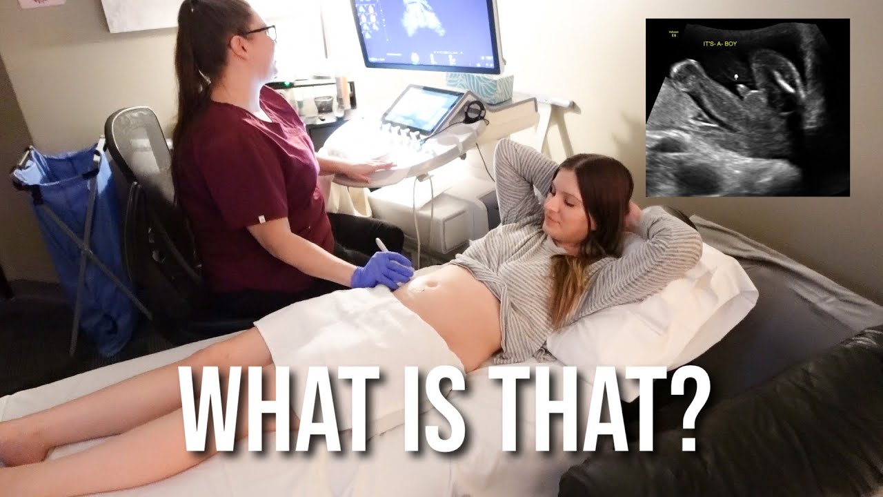 Did they get the baby's gender WRONG?