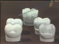 Types of Posterior Artificial Teeth