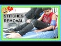 STITCHES REMOVAL | HOSPITAL