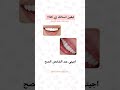 كيف تحصل على اسنان بيضاء كالثلج Glowup Teethwhitening Teethcleaning