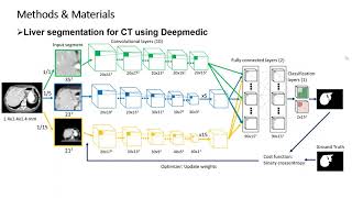 Famous HYBRID AI tutorials: CNN liver segmentation for CT Profile