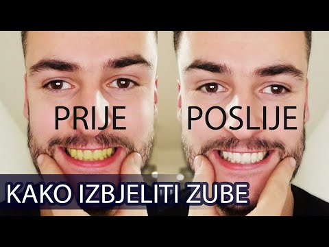 Video: Kako Izbijeliti Zube Kod Djeteta