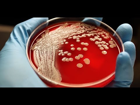 Video: L'1-monolaurina Inibisce La Crescita E Sradica Il Biofilm Formato Da Isolati Clinici Di Staphylococcus Epidermidis