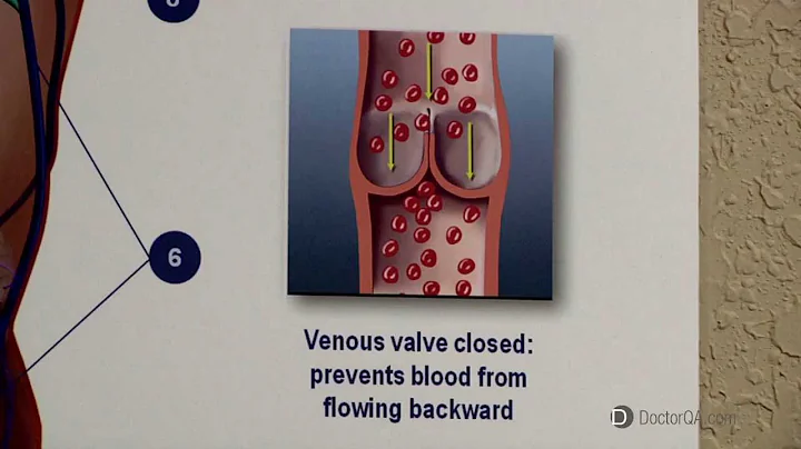 What is great saphenous insufficiency? - Dr. Willi...