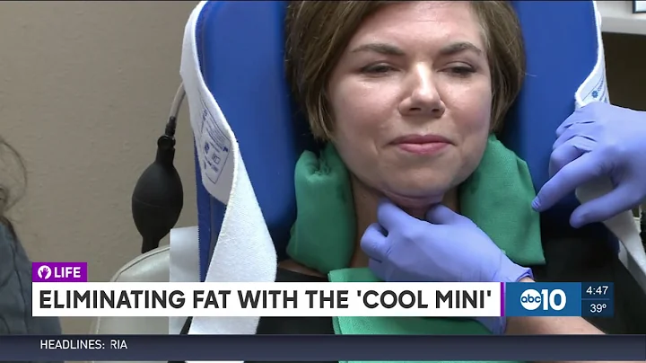CoolSculpting CoolMini Treatment for Double Chins ...