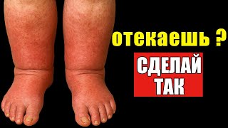 ОТЕКИ ИСЧЕЗНУТ! Простой метод с содой, который работает!