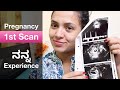 ನನ್ನ ಪ್ರೆಗ್ನನ್ಸಿ ಮೊದಲ ಸ್ಕ್ಯಾನ್ - ರಿಸಲ್ಟ್?! My Pregnancy First Scan Report & 1st Trimester Symptoms