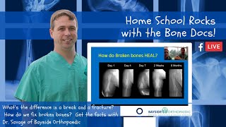 What's the difference in a break and a fracture? How do we fix broken bones? Ask the Bone Doc!