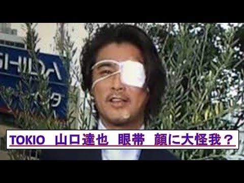 Tokio山口達也 顔に大怪我 眼帯姿でzipに登場怪我の真相は Youtube